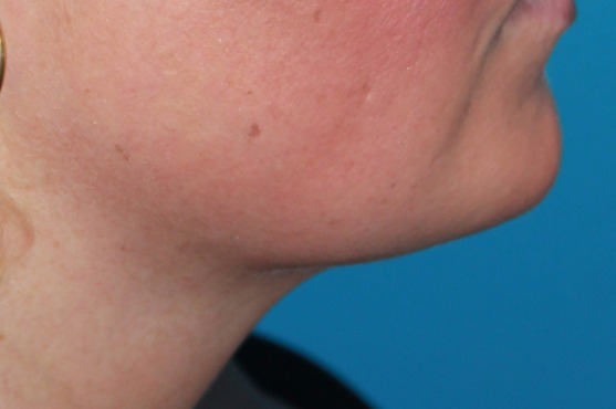 Profilo del viso e collo su sfondo blu