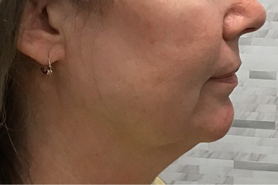 Profilo laterale di donna con mento e collo